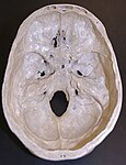 The lower inner surface of the neurocranium