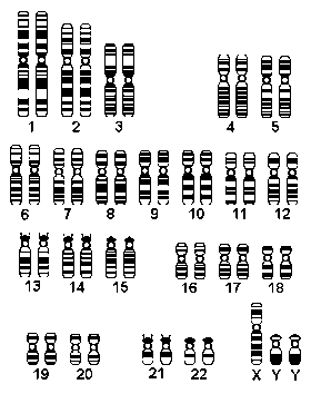 Chromosome xxxx XXXXY Karyotype