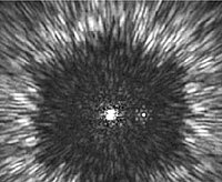 A simulated view of the coronagraph for Terrestrial Planet Finder. (Courtesy NASA/JPL-Caltech) Coronagraph starburst.jpg