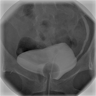 <span class="mw-page-title-main">Cystography</span> X-ray imaging of the urinary bladder