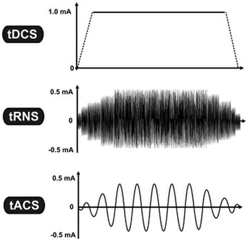 Neuroestimulació