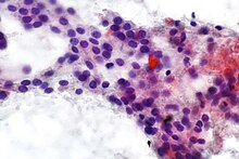 Hurthle cells - thyroid FNA - alt -- very high mag.jpg