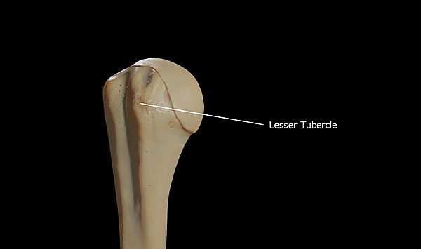 Lesser Tubercle of right humerus Lesser-Tubercle-of-Right-Humerus.jpg