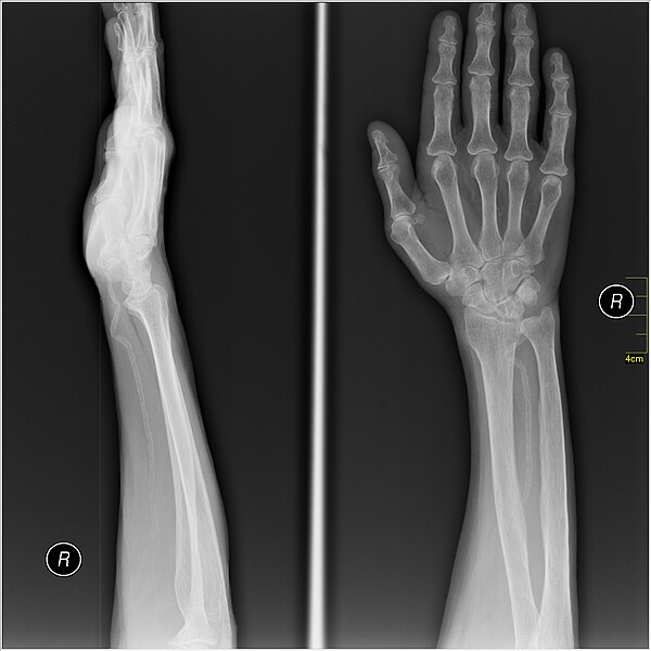 File:Medical X-Ray imaging VRY07 nevit.jpg