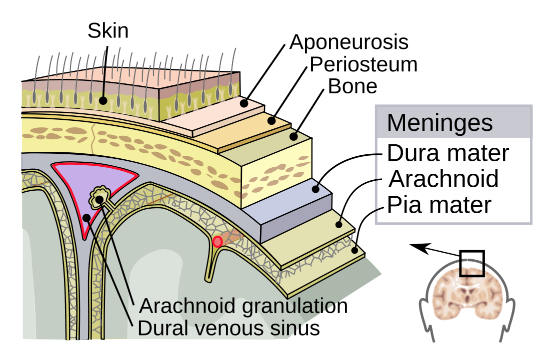 Meningitida