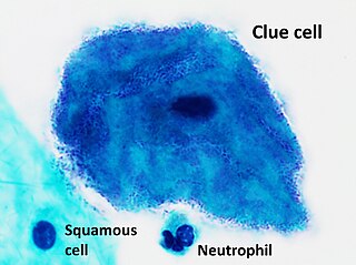 <span class="mw-page-title-main">Clue cell</span>