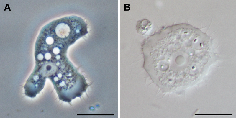 File:Parasite140120-fig3 Acanthamoeba keratitis.png