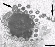 Электронная микрофотография вирусной фабрики в клетке амёбы, заражённой мимивирусом Mont1 и вирофагом Замилон. Стрелки указывают на ненормальные частицы мимивируса. Масштабная линейка 0,1 мкм
