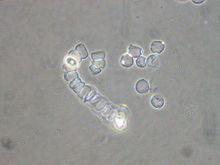 Acrasis rosea amoebae and spores under microscope Acrasis rosea 31330.jpg