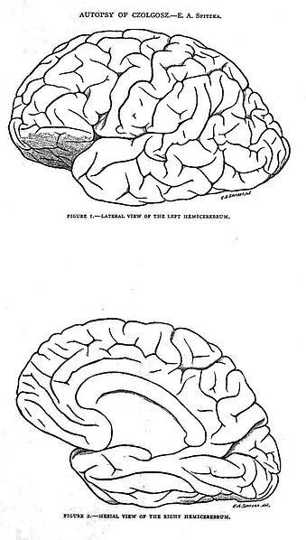 File:Autopsy drawings of brain of Leon Czolgosz.jpg