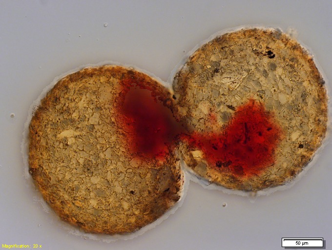 File:Collection Penard MHNG Specimen 275-1-6 Difflugia lithoplites.tif