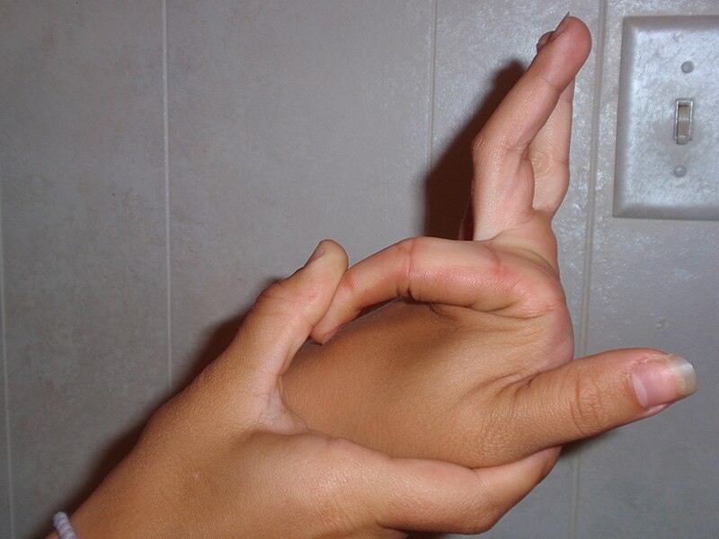 File:Doublejointedfinger.JPG