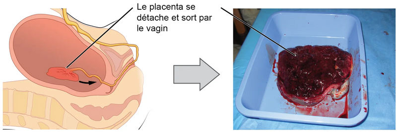 File:Expulsion placenta.png