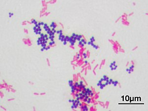 Gram-positive bacteria - Wikipedia