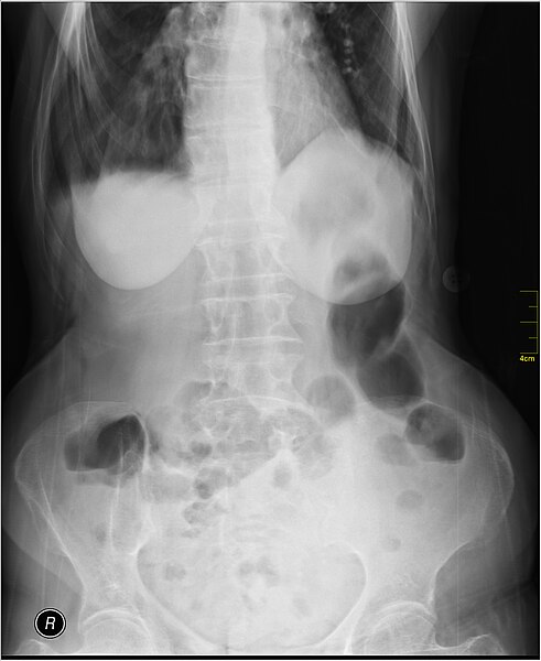 File:Medical X-Ray imaging VVQ07 nevit.jpg