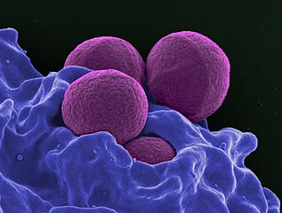 Human neutrophil ingesting Methicillin-resistant Staphylococcus aureus 