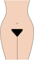 Représentation des poils pubiens chez une femme adulte ; ce triangle noir marque aussi toute la zone extérieure appelée couramment pubis.