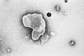 Human respiratory syncytial virus (Paramyxoviridae)