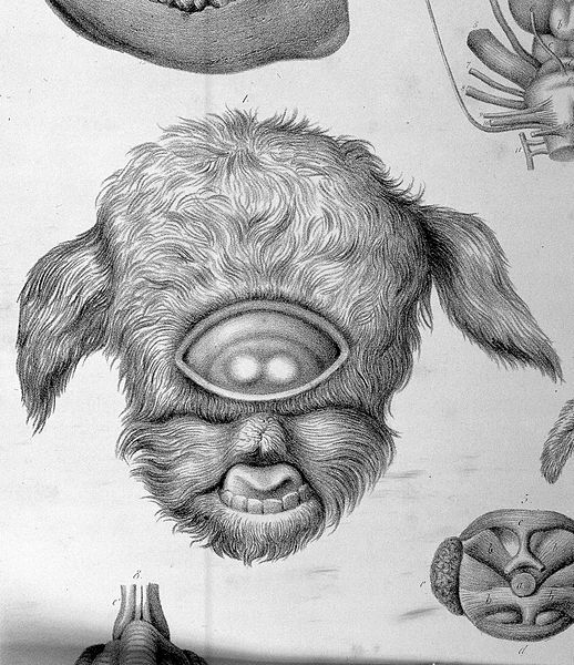 File:ABNORMALITIES; Tabulae ad illustrandam embry Wellcome L0032361.jpg