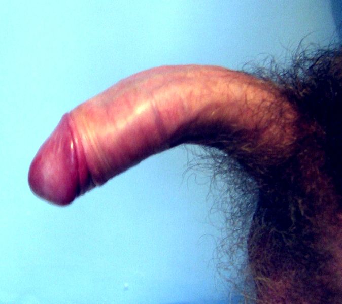 File:Bent Penis.jpg