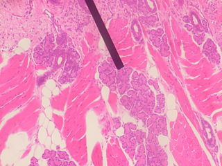<span class="mw-page-title-main">Von Ebner's gland</span> Exocrine glands found in the mouth