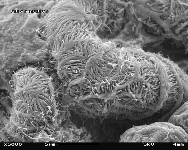 File:Glomerulum of mouse kidney in Scanning Electron Microscope, magnification 5,000x.GIF