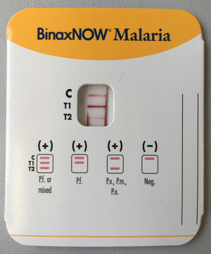 Malaria: Wortherkunft, Epidemiologie, Erreger