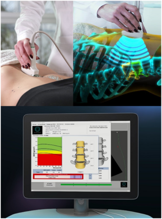 <span class="mw-page-title-main">Radiofrequency Echographic Multi Spectrometry</span> Medical diagnostic