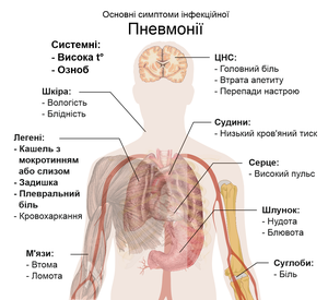 Схема людського тіла, що відображує основні симптоми пневмонії