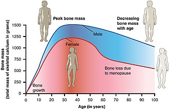 Bone density peaks at 35 and then decreases with age. 615 Age and Bone Mass.jpg