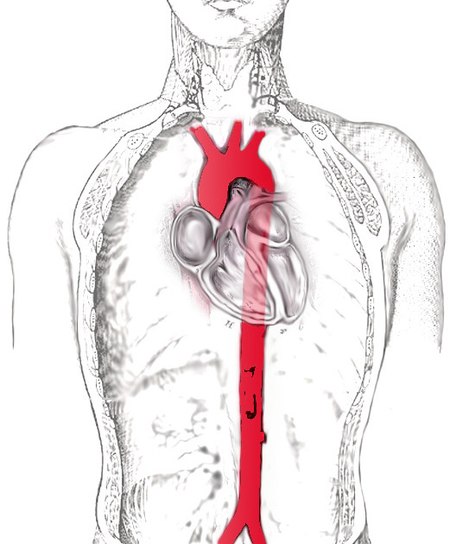 Aorta scheme.jpg