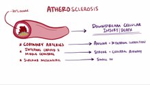 Datei:Arteriosclerosis & Atherosclerosis video.webm