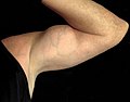 Biceps posing - Flickr - Stiller Beobachter.jpg