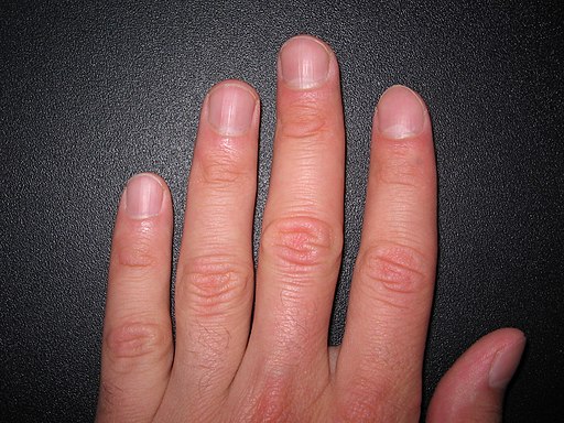 Fingernails1