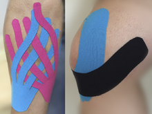 Kinesiology Taping and Sports Taping - What's the difference?