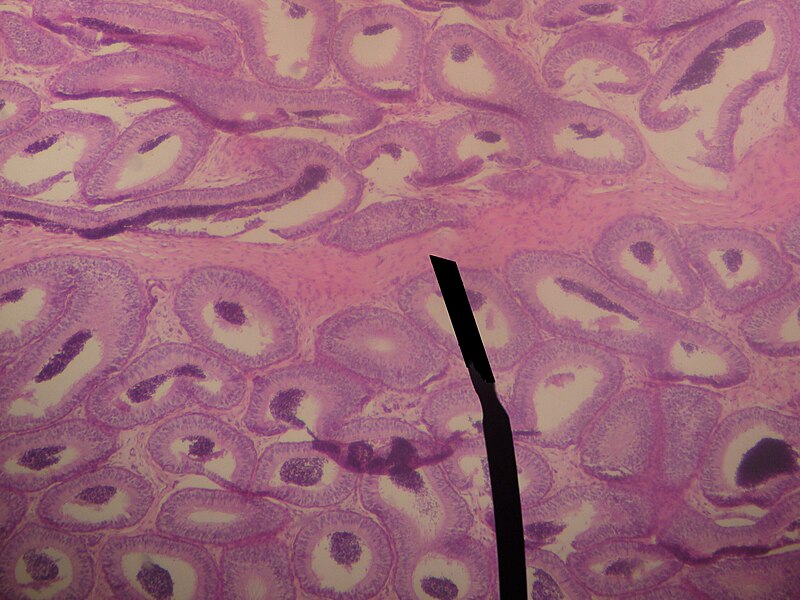 File:Mediastinum testis.JPG