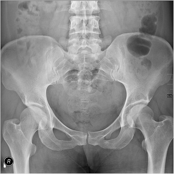 File:Medical X-Ray imaging DMT03 nevit.jpg