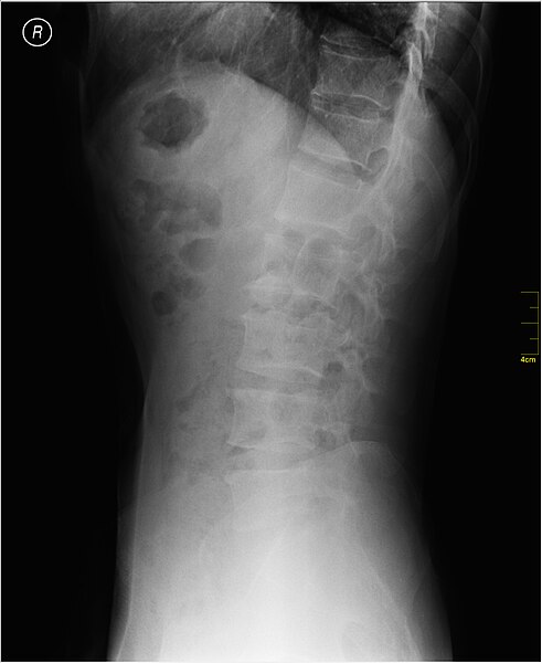 File:Medical X-Ray imaging WWP07 nevit.jpg