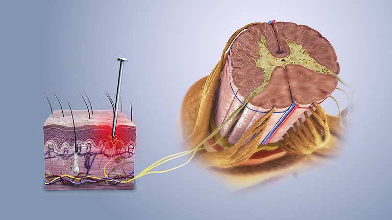 File:Nociceptive pain.jpg