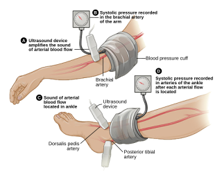 <span class="mw-page-title-main">Ankle–brachial pressure index</span> The ratio of the blood pressure at the ankle to the blood pressure in the upper arm