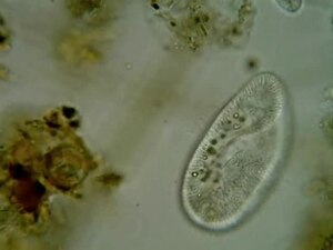 Paramecium putrinum.ogv