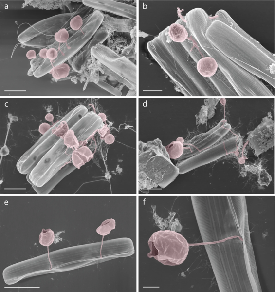 File:Pennate diatoms infected with chytrid-like fungal pathogens.webp