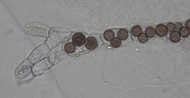 Rozella allomycis в клетках хитридиомицета Allomyces