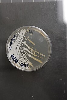 Streptomyces natalensis NRRL B-5314 (Type Strain).jpg