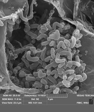 Symbiotic nitrogen fixing bacteria inside legume root nodule cells.tif