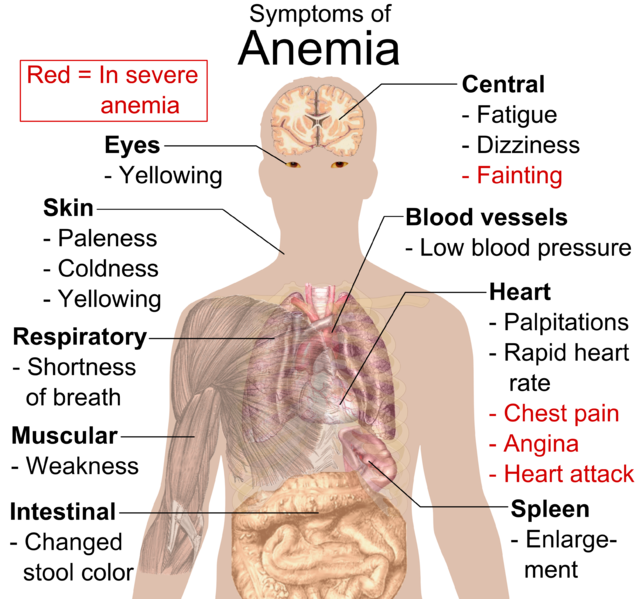 Main symptoms that may appear in anaemia