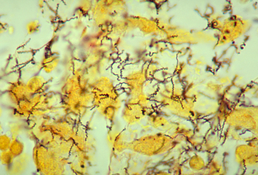 Treponema pallidum - типовий вид спірохет