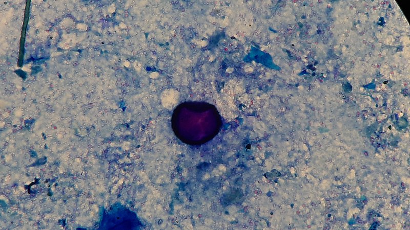 File:An egg of Taenia in Ziehl-Neelsen stained smear of faeces jpg.jpg