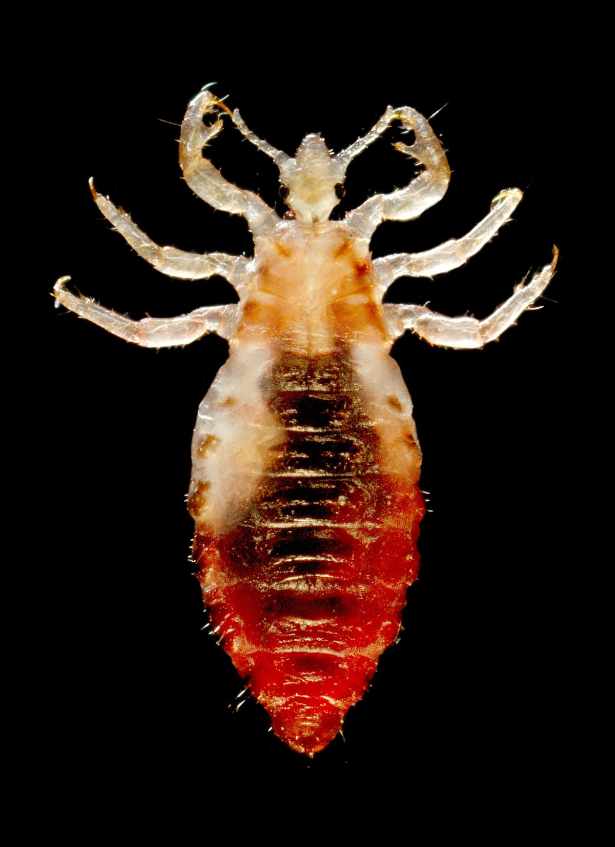 Body louse - Wikipedia