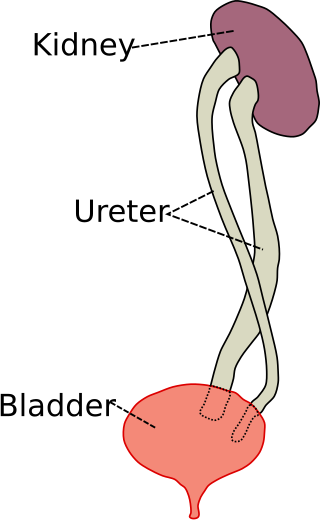 <span class="mw-page-title-main">Duplicated ureter</span>